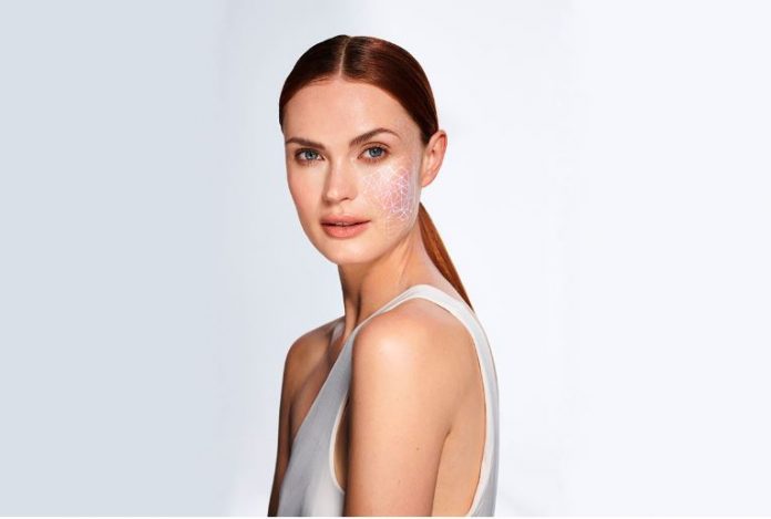 avon